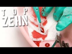 10 bizarre medizinische Eingriffe 10 bizarre medizinische eingriff