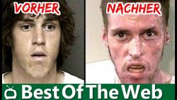 bilder vor und nachdem man droge