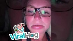 Frau mit dicker Lippe frau mit dicker lippe