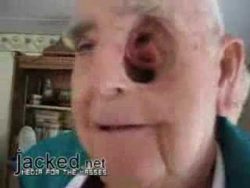 loch im kopf der arme mann