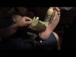 Wenn sich die Haut an den Füßen schuppt wenn sich die haut an den fuesse