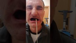 zaehne ziehen leicht gemacht abe